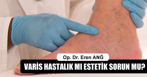 Estetik sorun mu